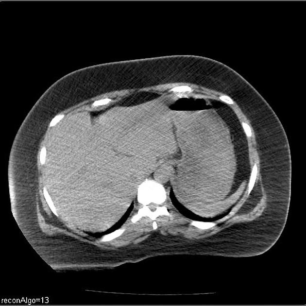 ct-artifacts-pacs